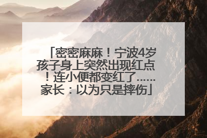 密密麻麻！宁波4岁孩子身上突然出现红点！连小便都变红了……家长：以为只是摔伤